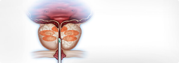 measuring the treatment plan header